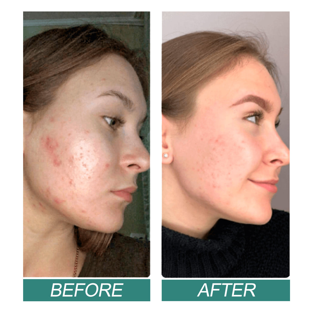 f7b62c81-09f0-486b-801c-9efec5136556